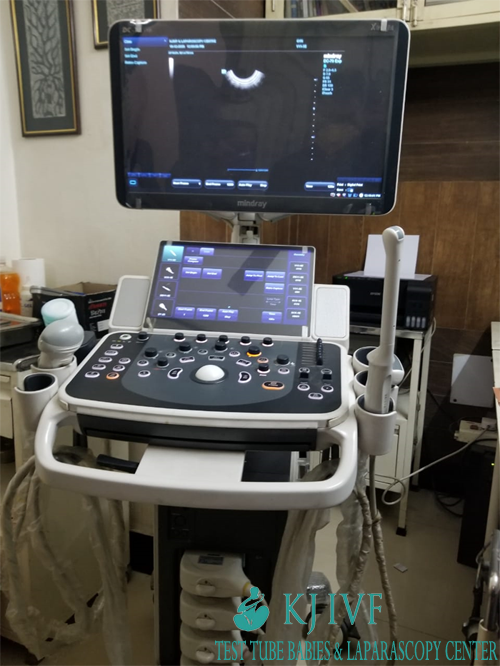 Ultrasound-for-Infertility