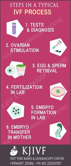 ivf centre delhi