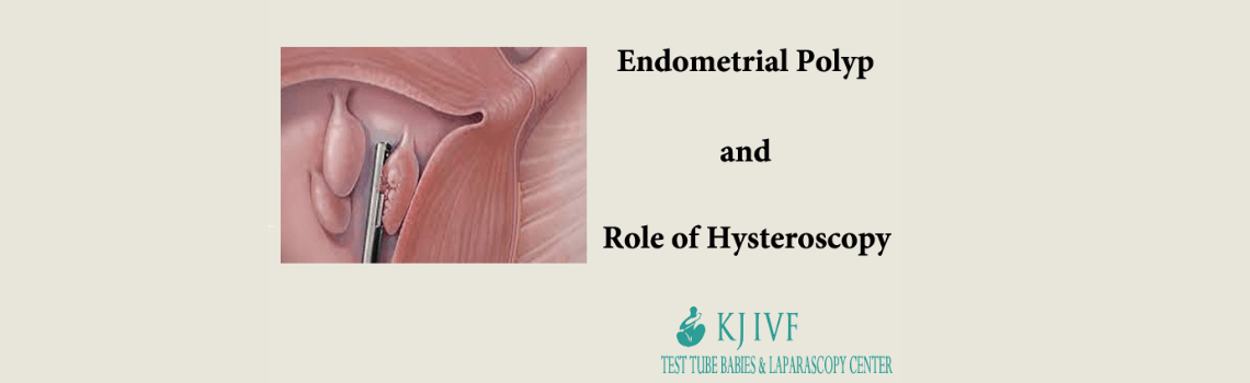Endometrial Polyp and Role of Hysteroscopy