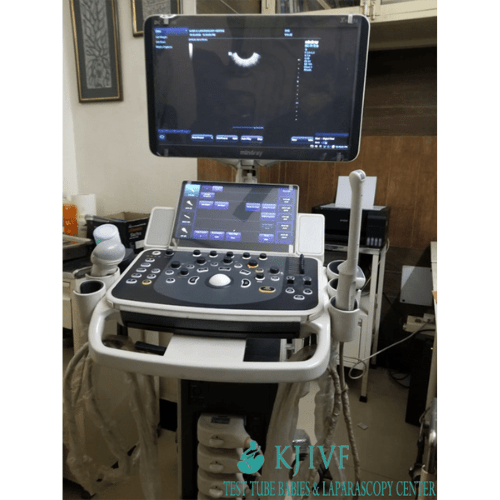 Ultrasound for Infertility